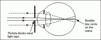 Schematic of Human Eye with Pin Hole lens